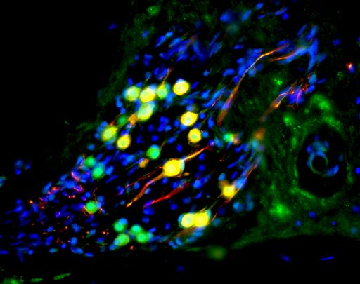 This undated photo provided by Nature shows cells in the inner ear of a deaf gerbil. The yellow ones are nerve cells derived from human embryonic cells. These cells improved the hearing of the gerbils, in an experiment that may someday help human patients.