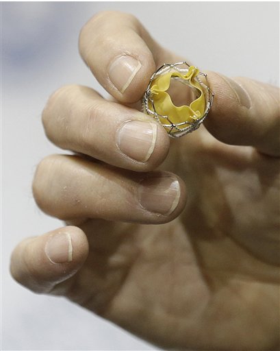 Atlanta cardiologist Dr. Spencer King holds a replacement heart valve. Millions of people have valve problems – each year, more than 100,000 people in the United States alone have surgery for them.
