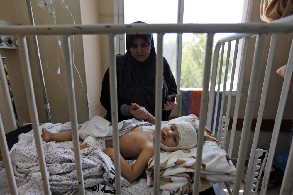 Palestinian Sama Al Ajouz, 2, lays on a hospital bed in Gaza City, in the northern Gaza Strip, Monday, July 28, 2014. Al Ajouz was wounded by shrapnel to the scull during an Israeli strike. According to her parents, the doctors told them she needs specialist treatment, including brain surgery.