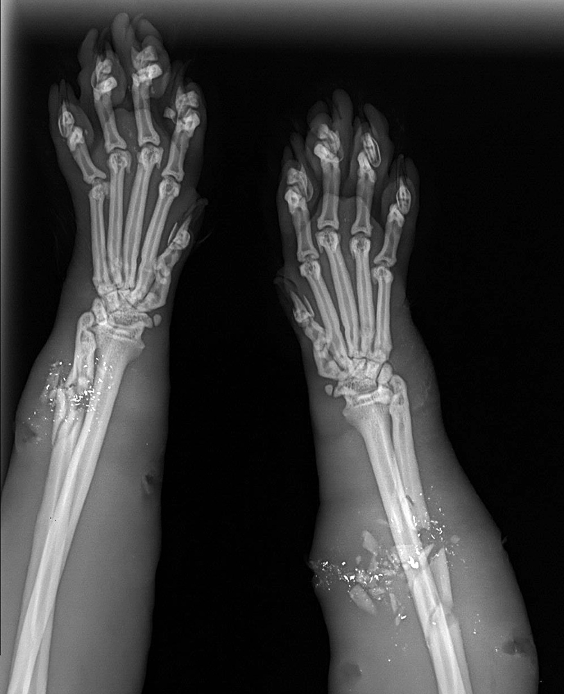 An X-ray of Clark the cat shows the shattered bones in his front legs Wednesday at the Animal Refuge League in Westbrook. Pellets from a 16-gauge shotgun used by a police officer, who thought the animal was rabid, shattered one bone in each of the cat’s front legs. The cat was a longtime stray in Gorham, where a local resident, Deb Webb, fed him regularly over the years.