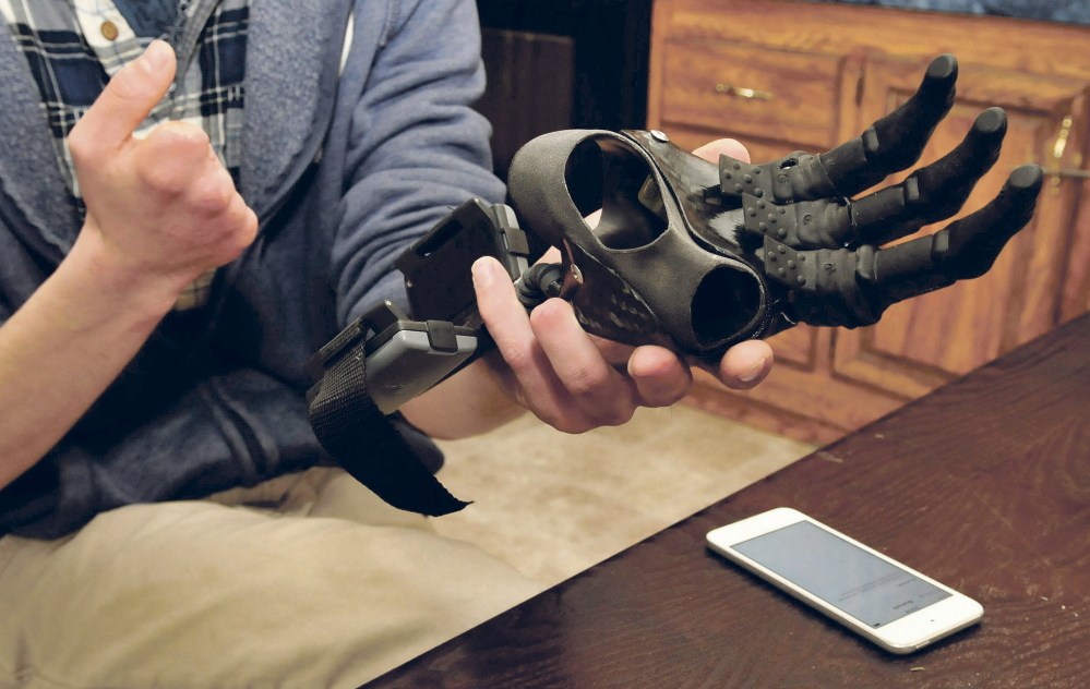 Nick Stafford prepares to attach a prosthesis to his right hand that was seriously injured in a mill accident.
