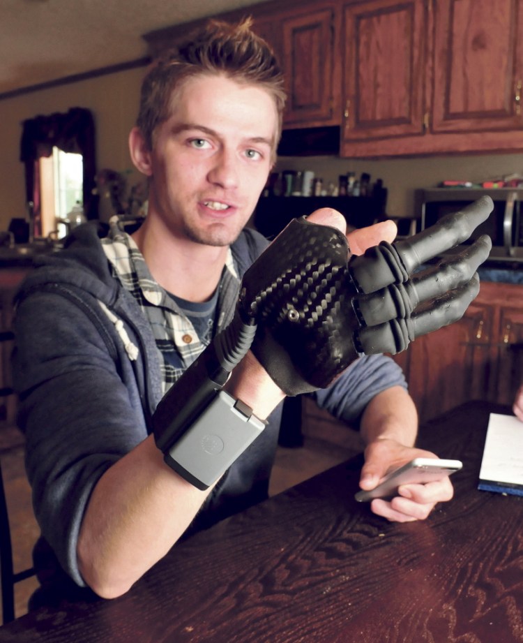 Nick Stafford, of Athens, wears the prosthesis he now uses since his right hand was seriously damaged in a mill accident.