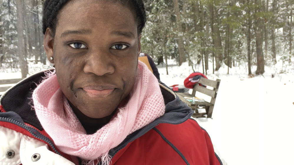 Frannie Santil, 13, of New York City, who suffered life-threatening burns when she was 6, describes the annual Fire and Ice Burn Survivors Winter Camp as her second home.
Susan Kimball photo