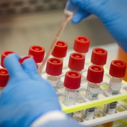 Poll Trust in Science